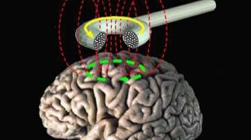 Transcranial magnetic stimulation. Picture by Wikimedia Commons