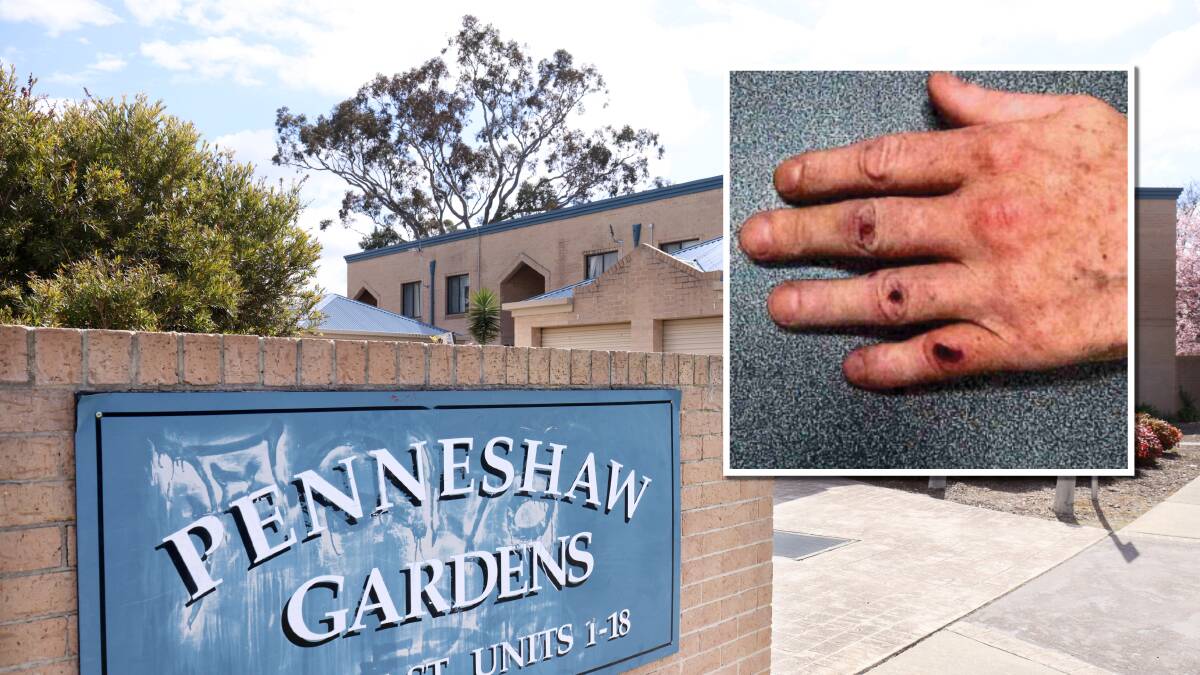 A police image of Oldfield's hand taken days after the Kambah housing complex murder. Pictures by James Croucher, supplied