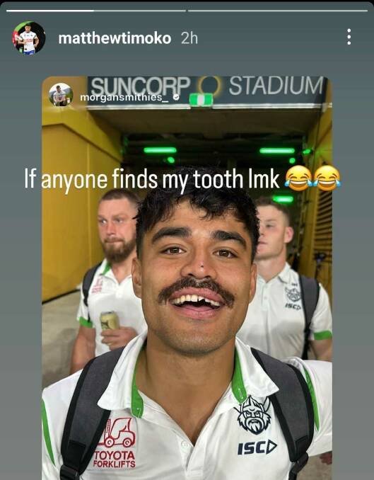 Matt Timoko chipped his tooth during a win over the Bulldogs. Picture Instagram