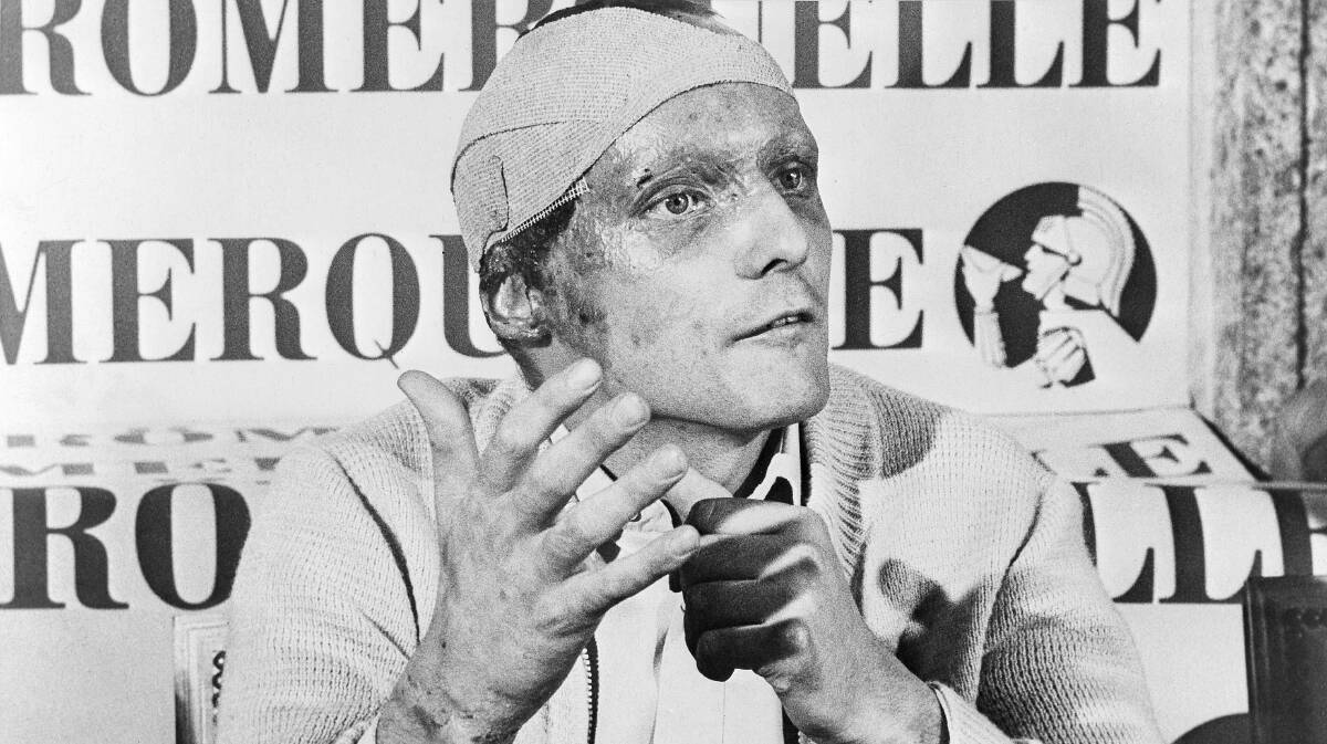 Niki Lauda, following his near fatal crash at the German Grand Prix six weeks prior, announces he would start at the Italian Grand Prix at Monza at a press conference in 1976.