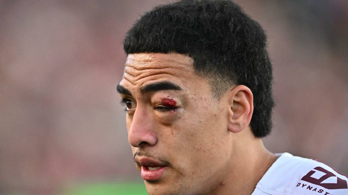 Lehi Hopoate's fractured eye socket was the only down side for Manly. (James Gourley/AAP PHOTOS)